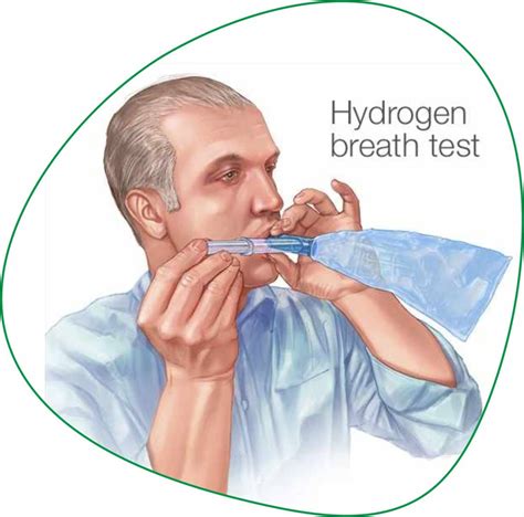 We leverage science, technology and innovation to accomplish our mission getting you answers that help you make clear, confident decisions about your health. . Hydrogen breath test labcorp